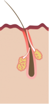 Hair follicle diagram