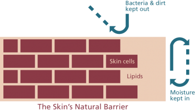 Skin barrier diagram