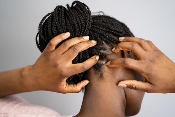 Femme de dos, se grattant le cuir chevelu